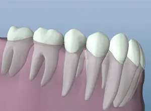 Healthy Tooth