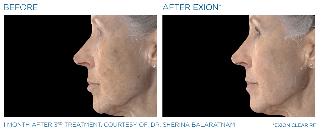 Before & After Photos