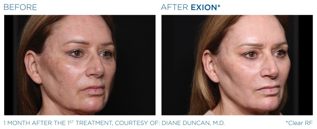 Before & After Photos