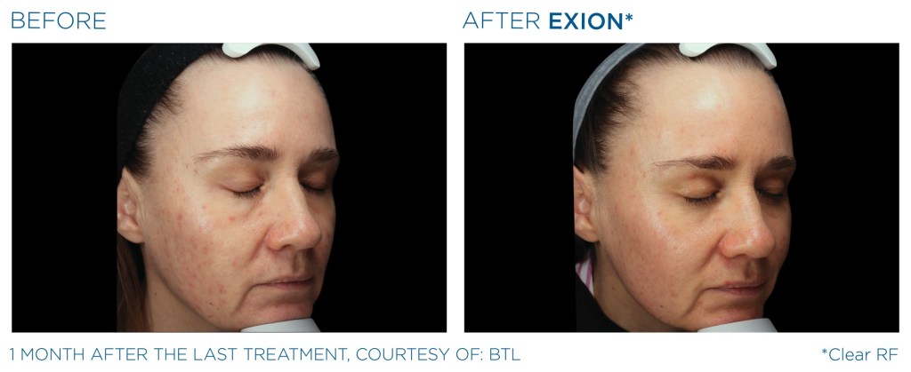 Before & After Photos